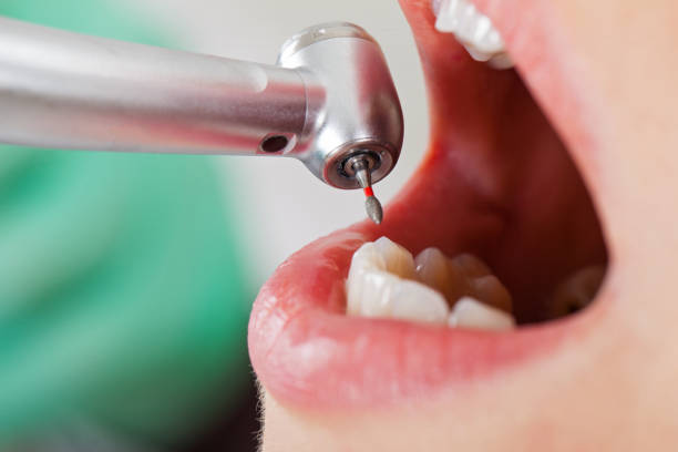 Best Emergency Tooth Extraction in Cave City, AR